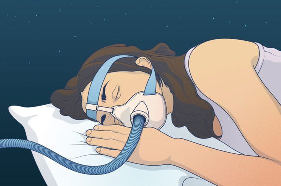 Diagnosing and Treating Sleep Apnea